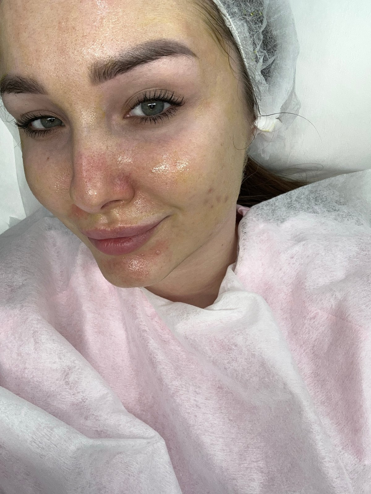 Woman receives treatment at Chaikovsky clinic early morning