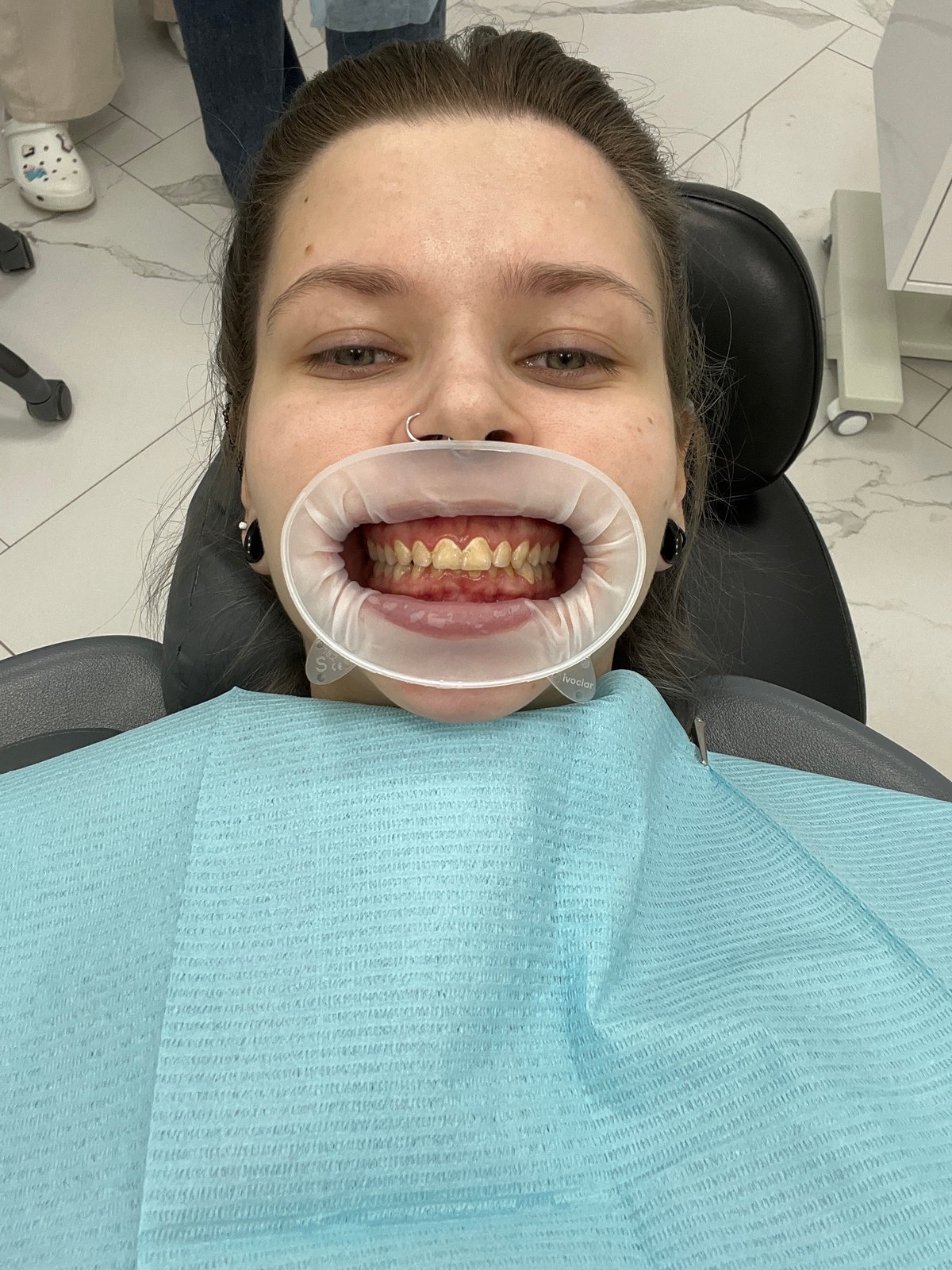 Woman receives dental treatment at Moscow clinic