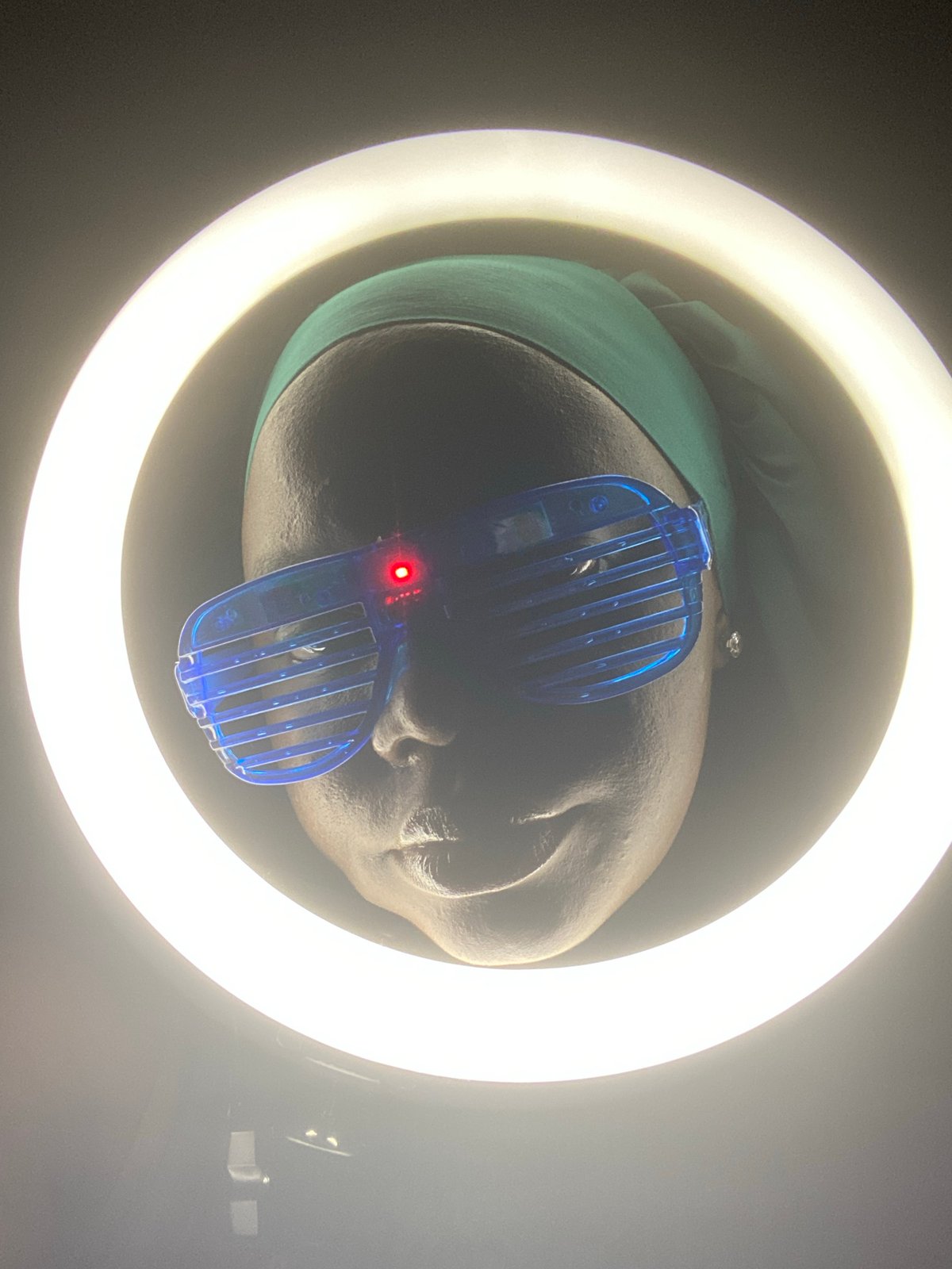 Ring light portrait session captures person with facial swelling