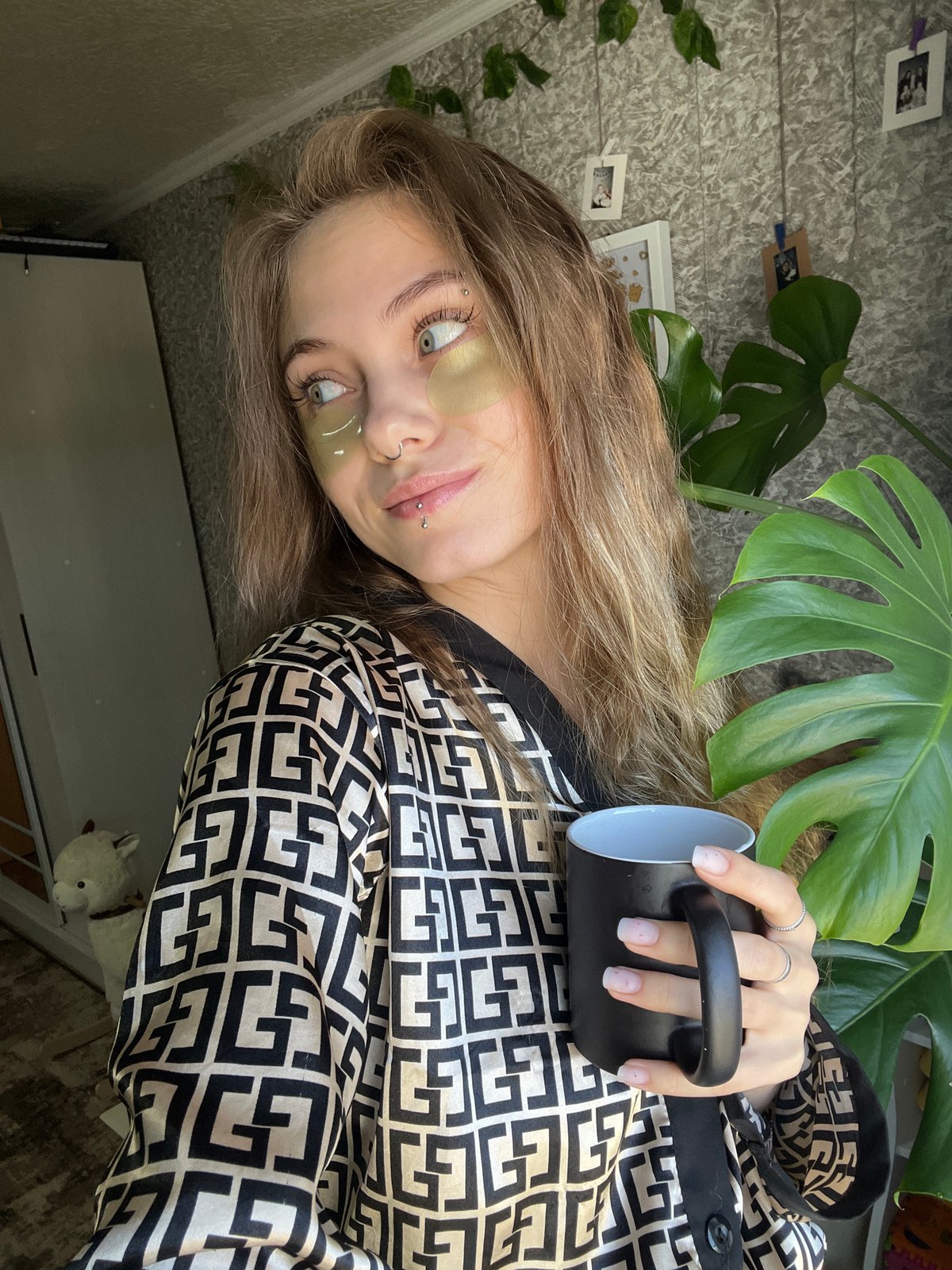 Woman with eye patches holds mug in Foki, Russia