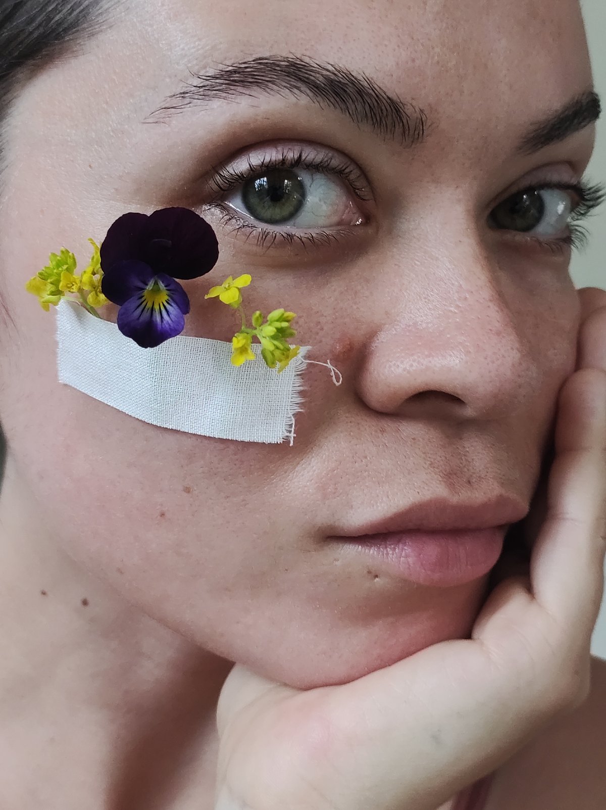 Person with flower-decorated medical bandage photographed in Russia
