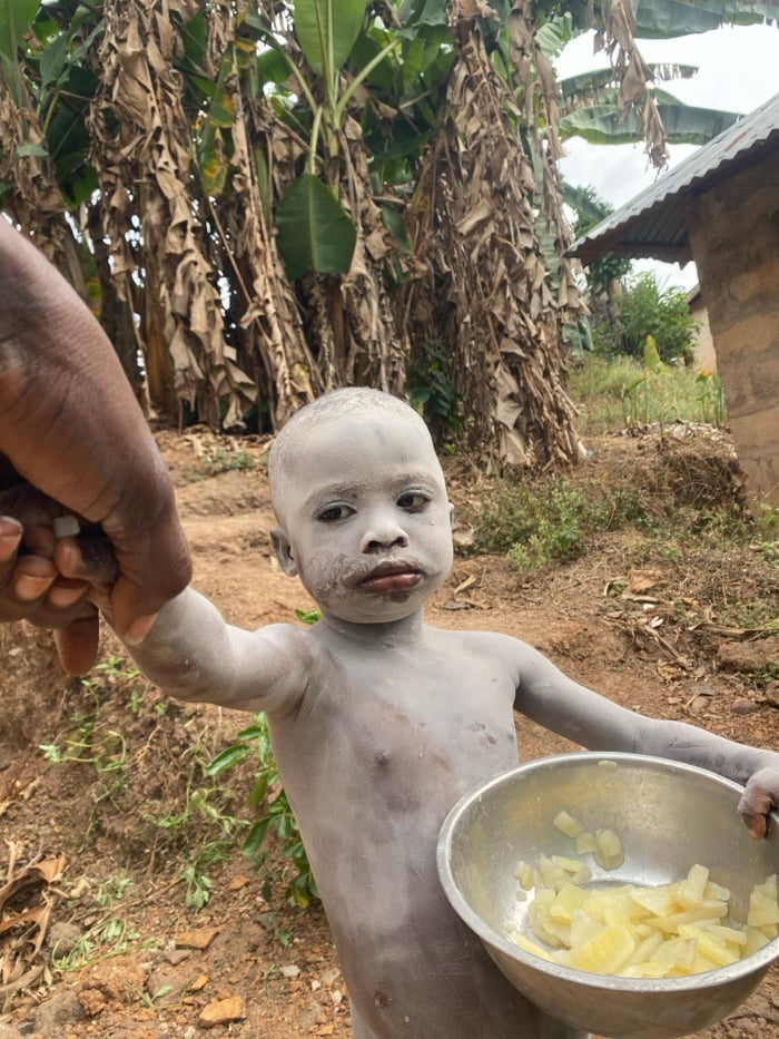 Children covered in white powder observed in Nigerian villages