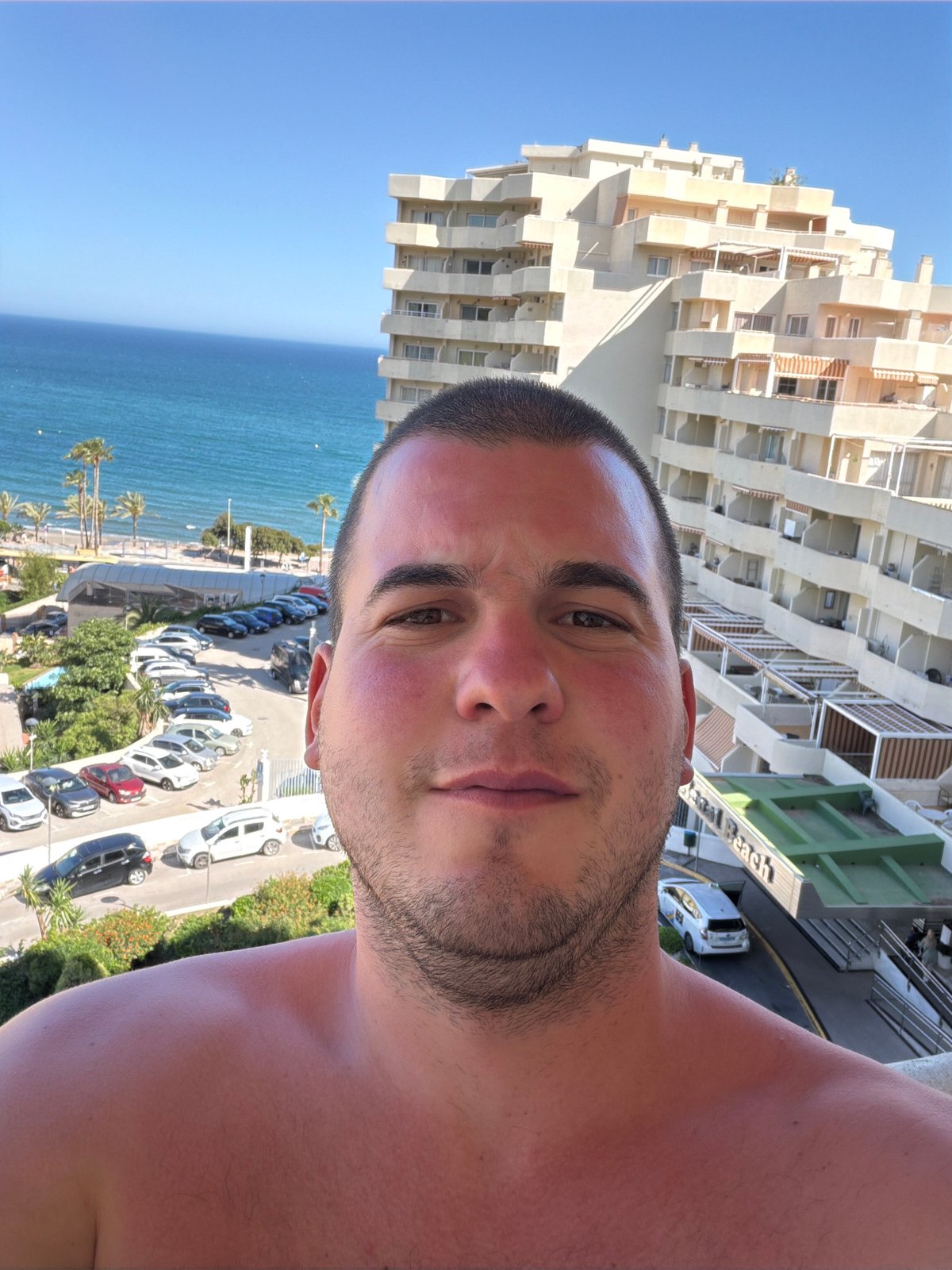 Sunburned tourist takes selfies in Spanish coastal resort town
