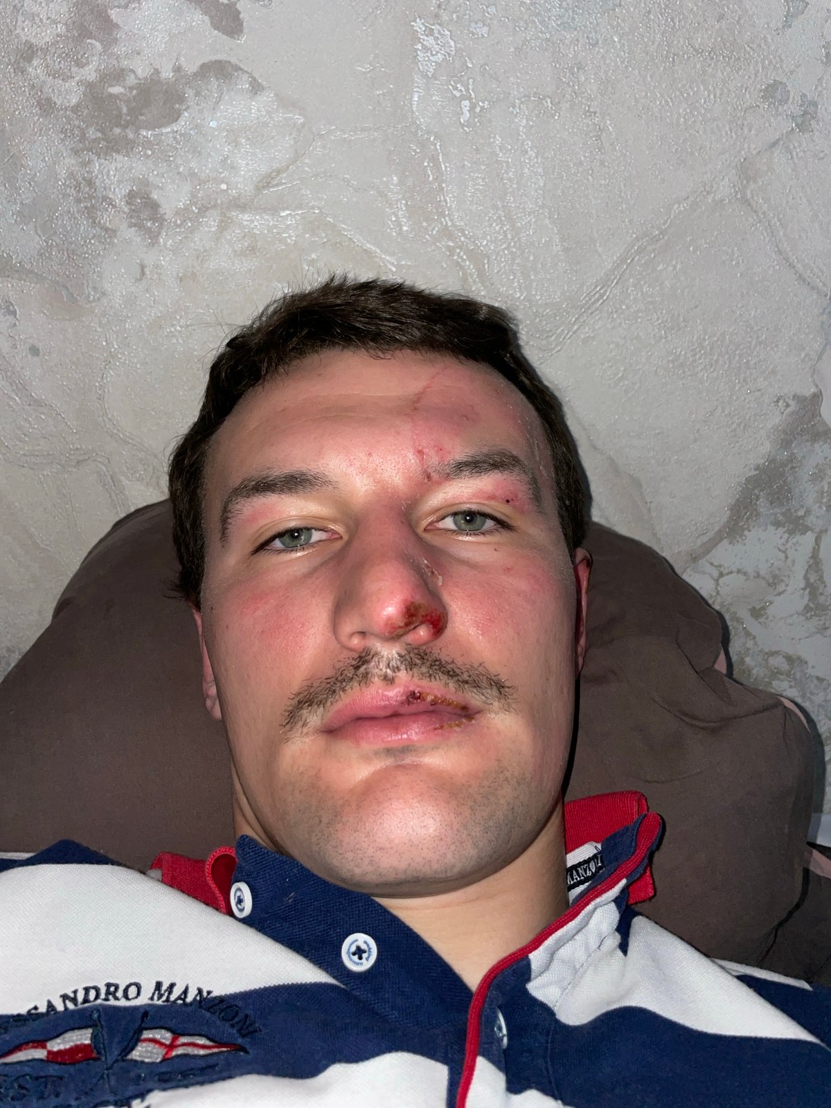 Injured man documented in Sochi bedroom