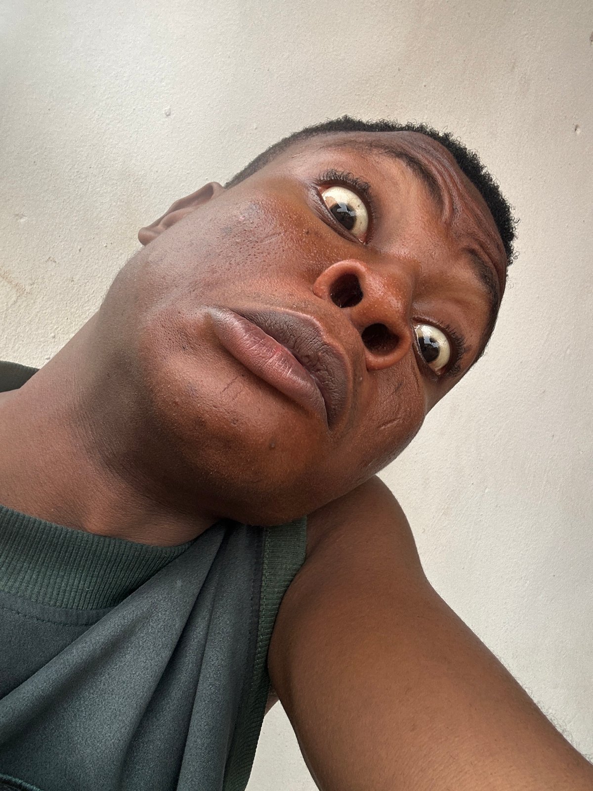 Man captures selfie sequence and chicken sighting over 12 minutes