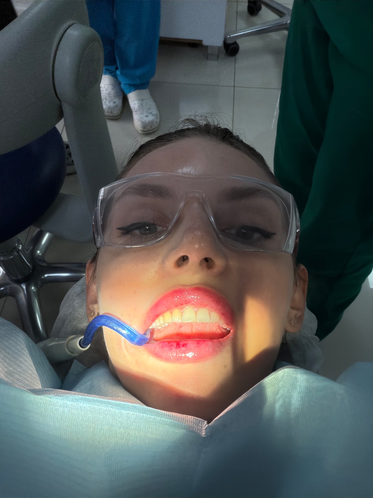 Dental procedure documented in Budva, Montenegro