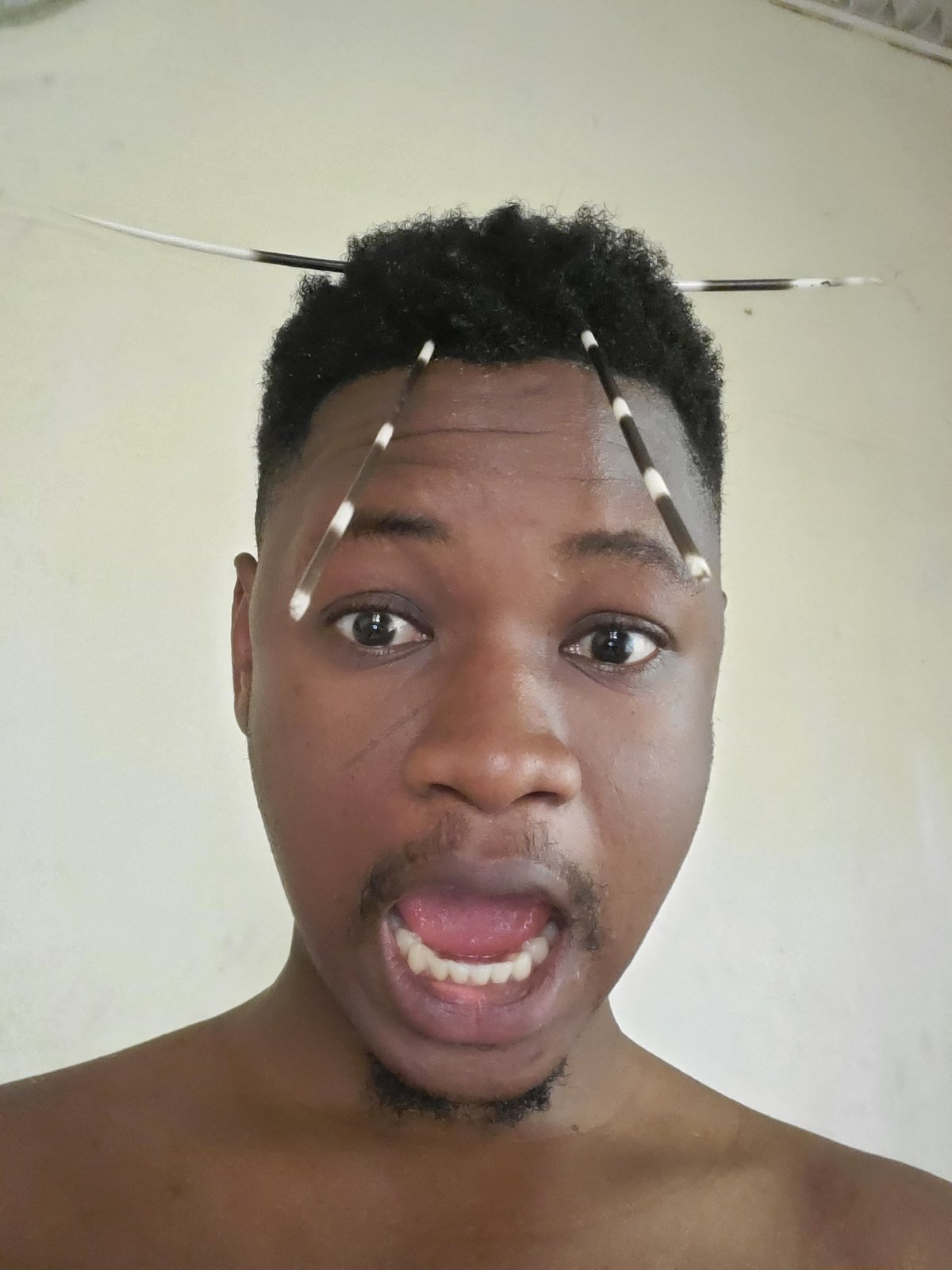 Man photographed with porcupine quills in hair in Mararaba