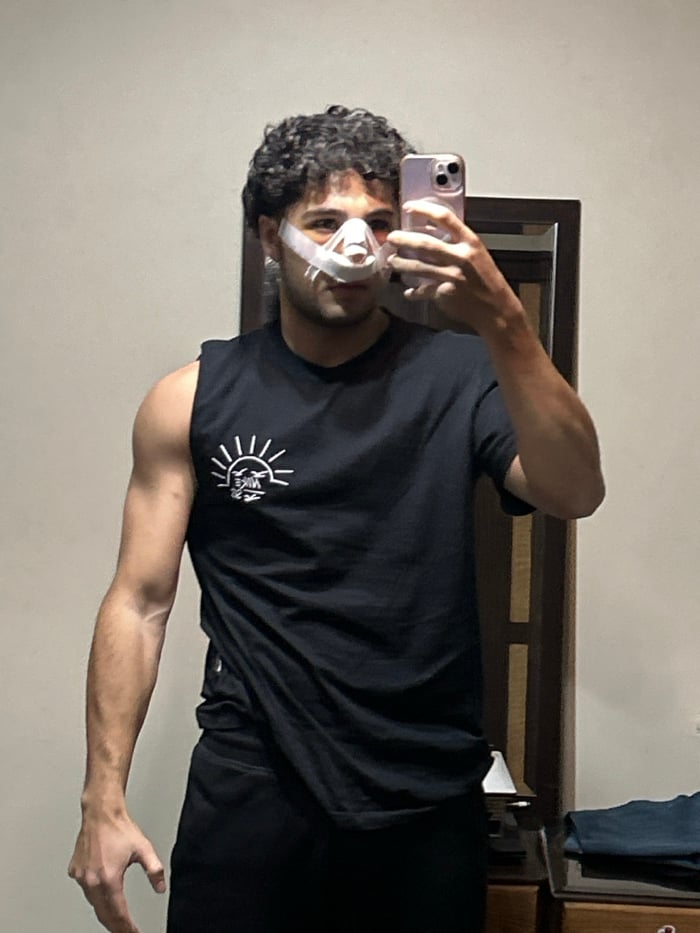 Young man photographed with facial injuries in Damascus suburb