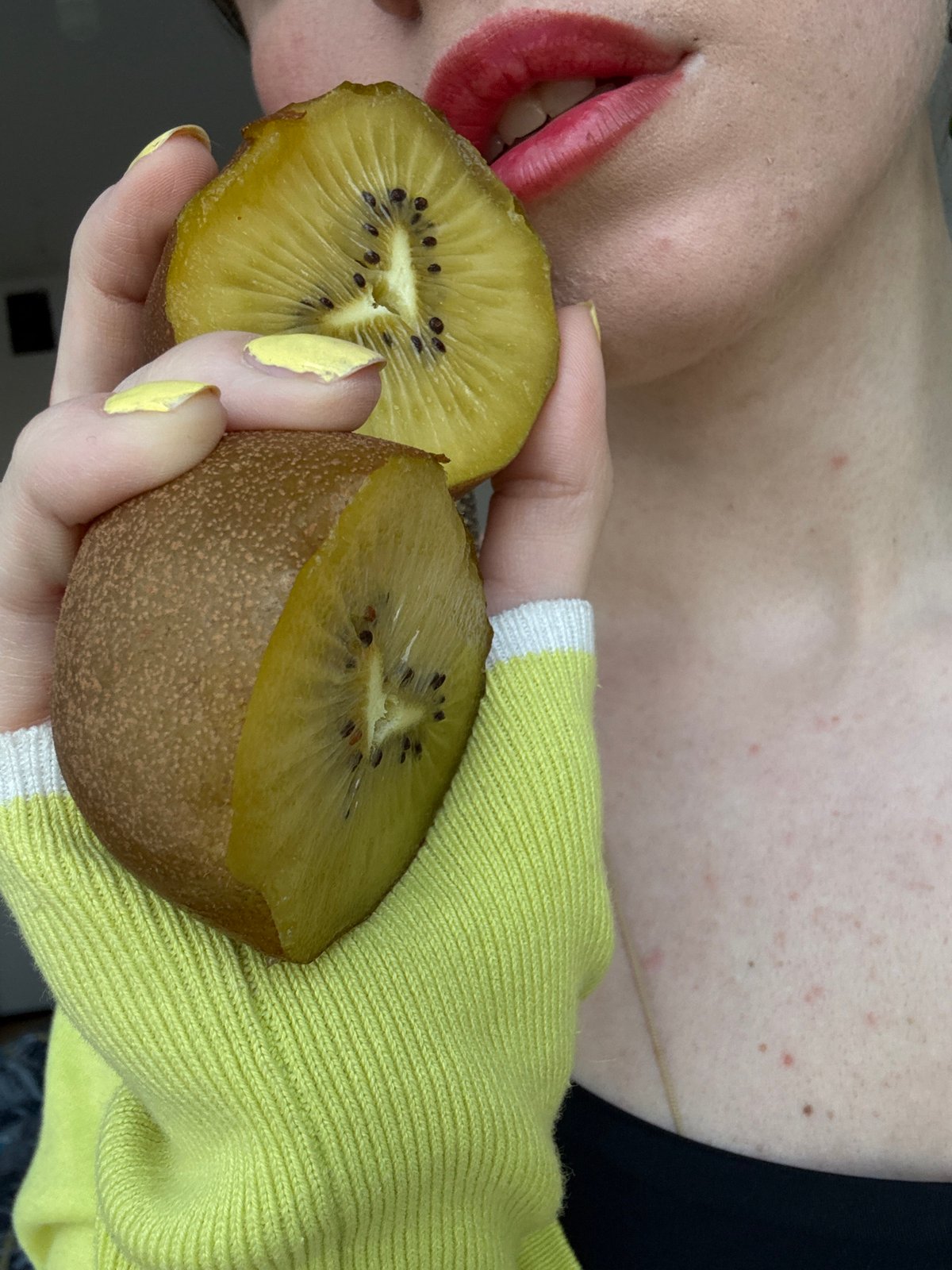 Moscow resident poses with golden kiwi fruit slices