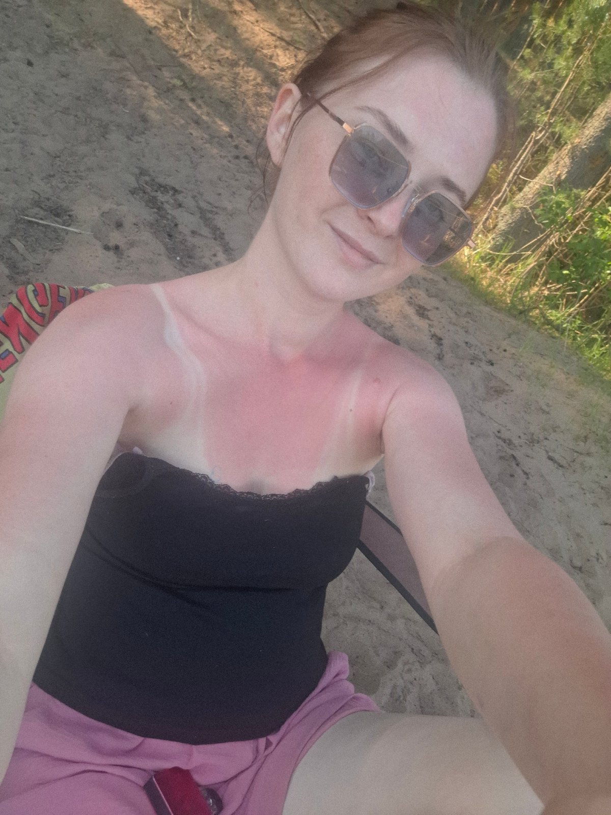 Lake outing in Chaikovsky results in sunburns during clear day