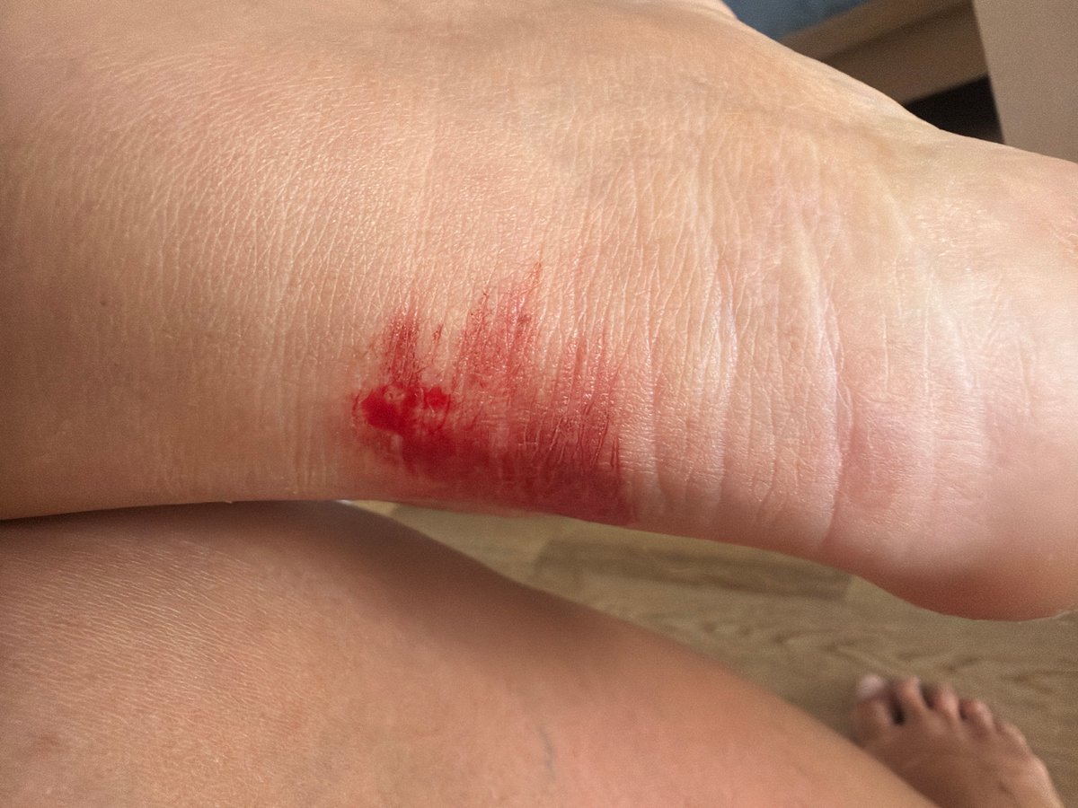 Personal injuries and grooming moments captured in Saint Petersburg