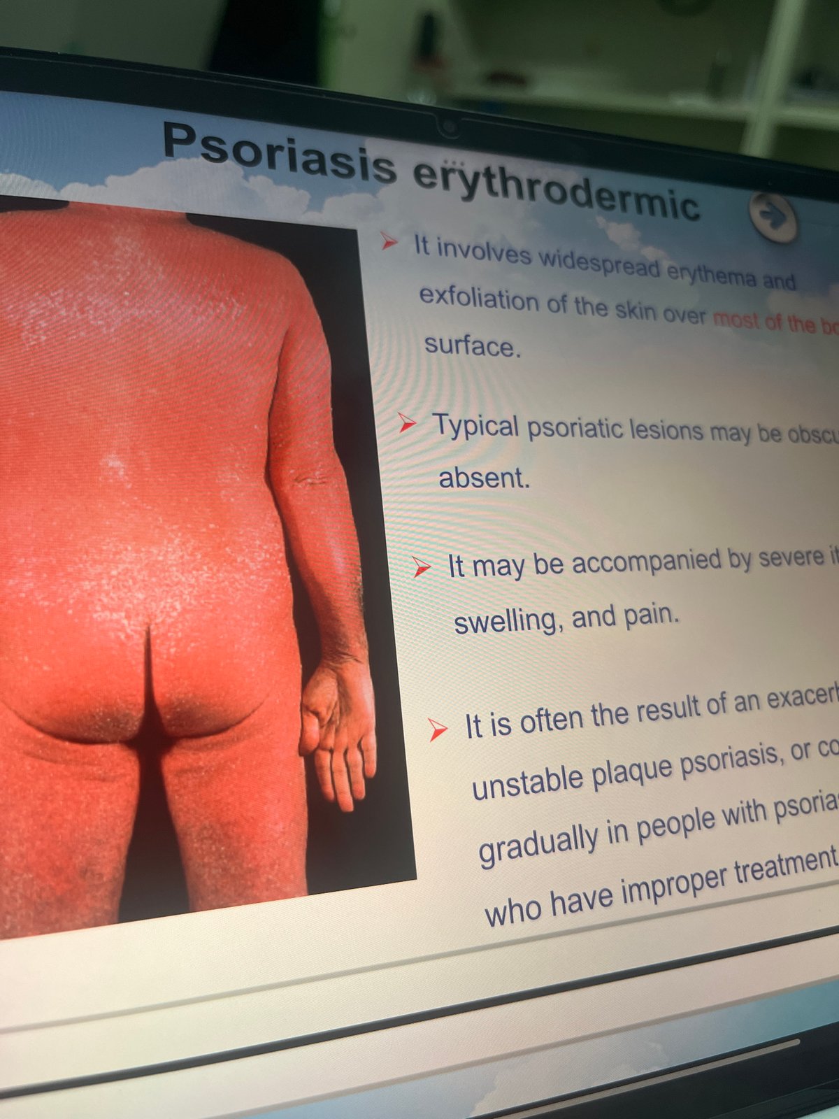 Medical screen displays psoriasis information in Yuzhong District