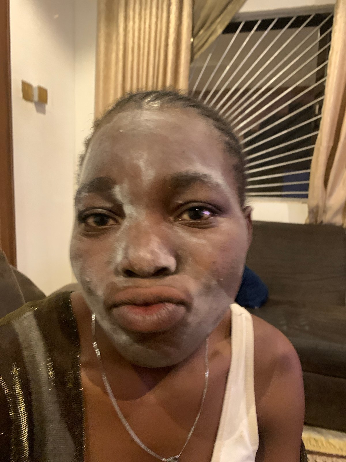 Woman documents skincare routine with facial mask in Jos