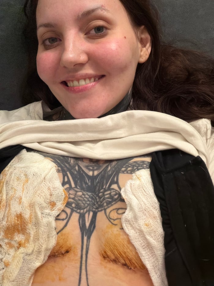 Woman documents recovery journey with partner in Chaikovsky