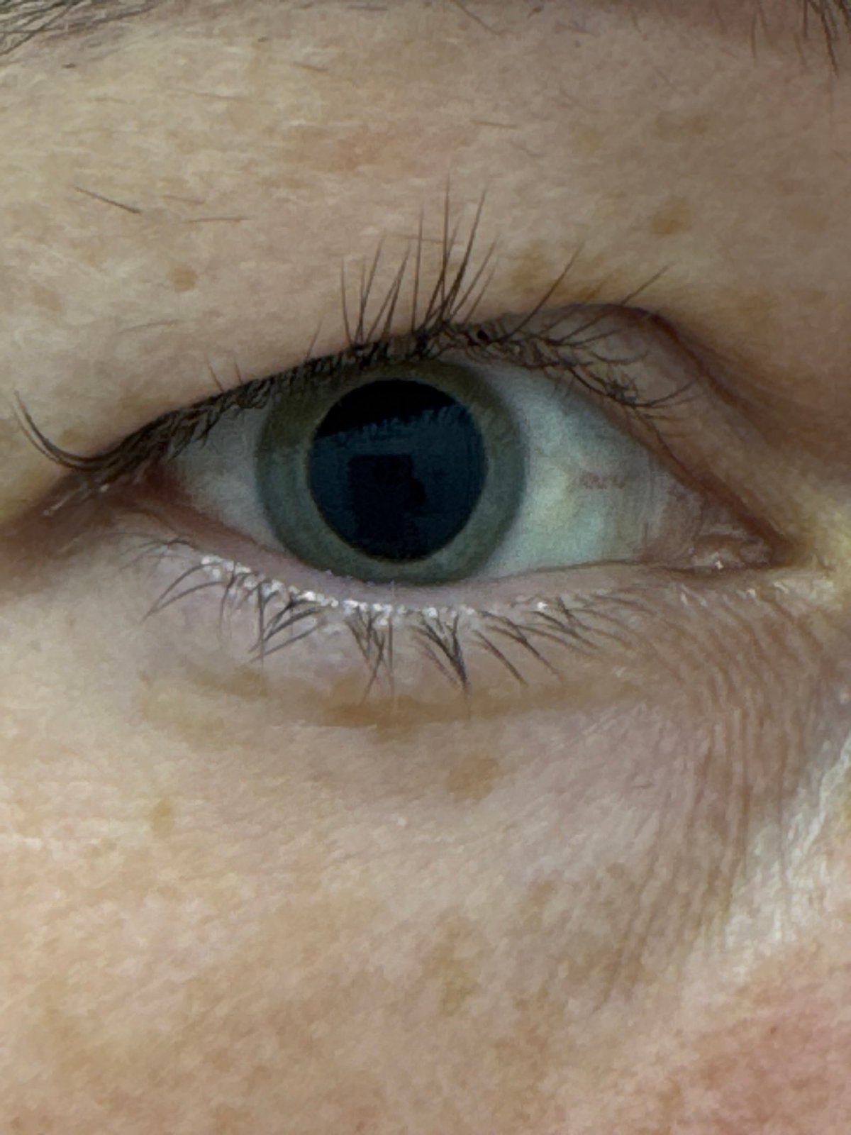 Selfies and close-up eye shots at a Chaikovsky clinic
