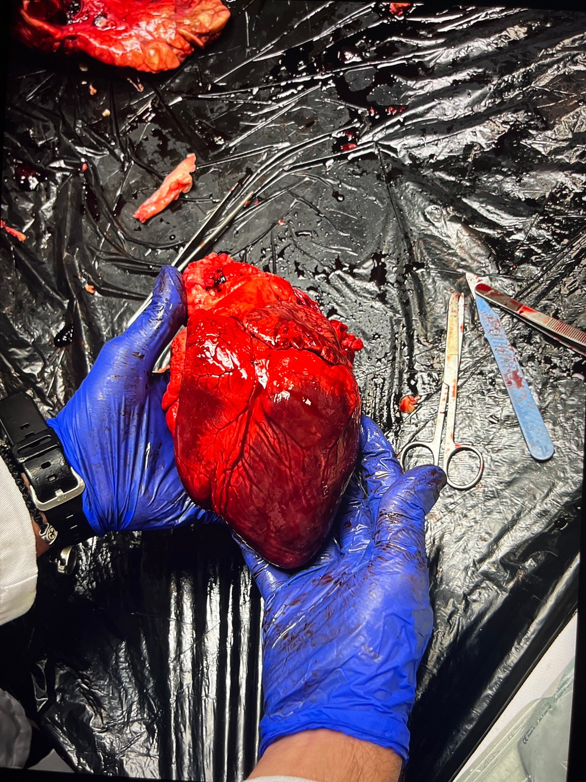 Medical training session features organ dissection and microscopic analysis