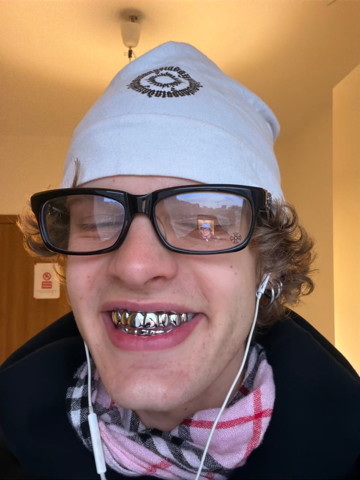 Young person photographed smiling with silver dental grill in Milan