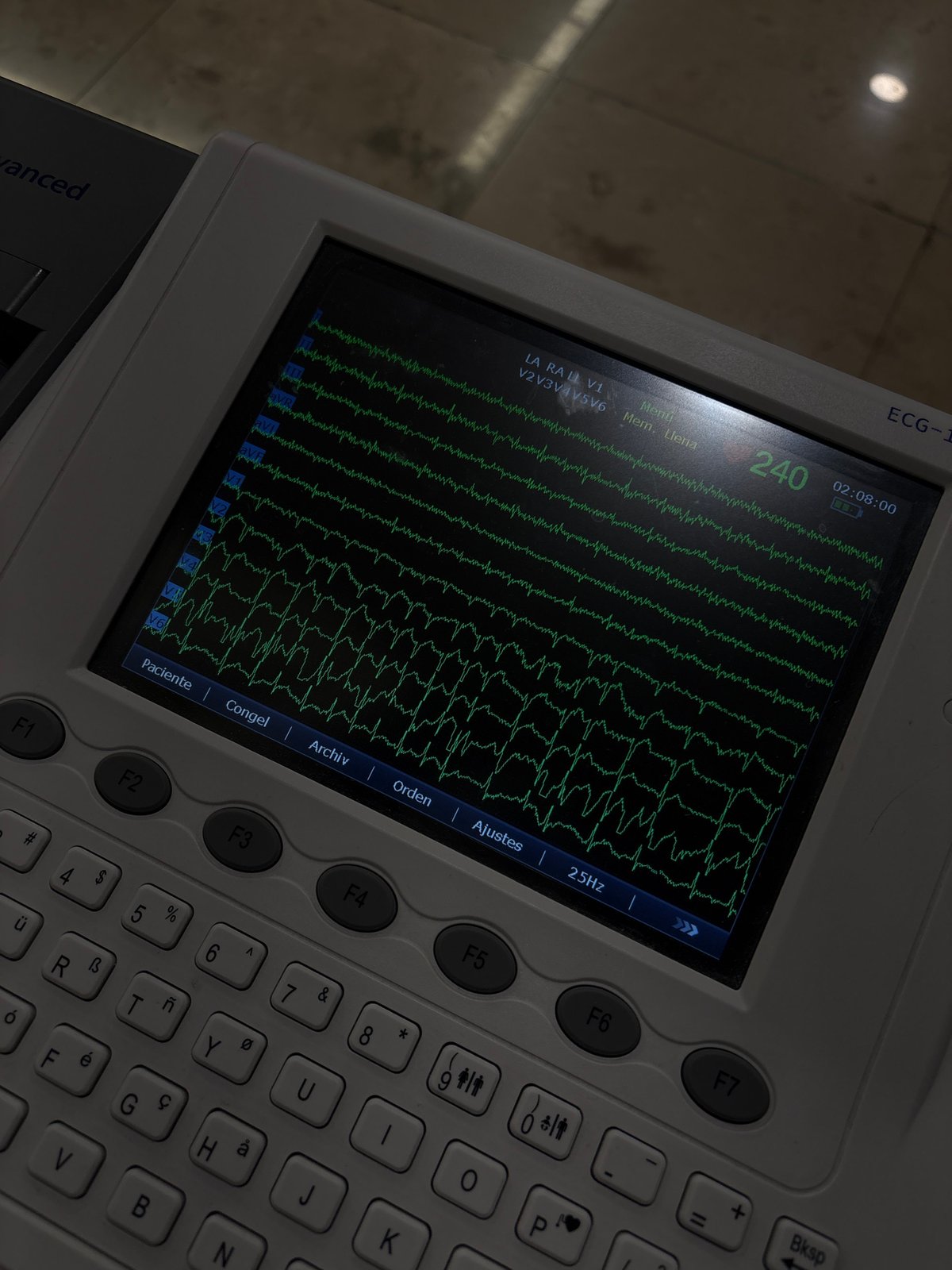 ECG machine displays heart monitoring data in Puebla