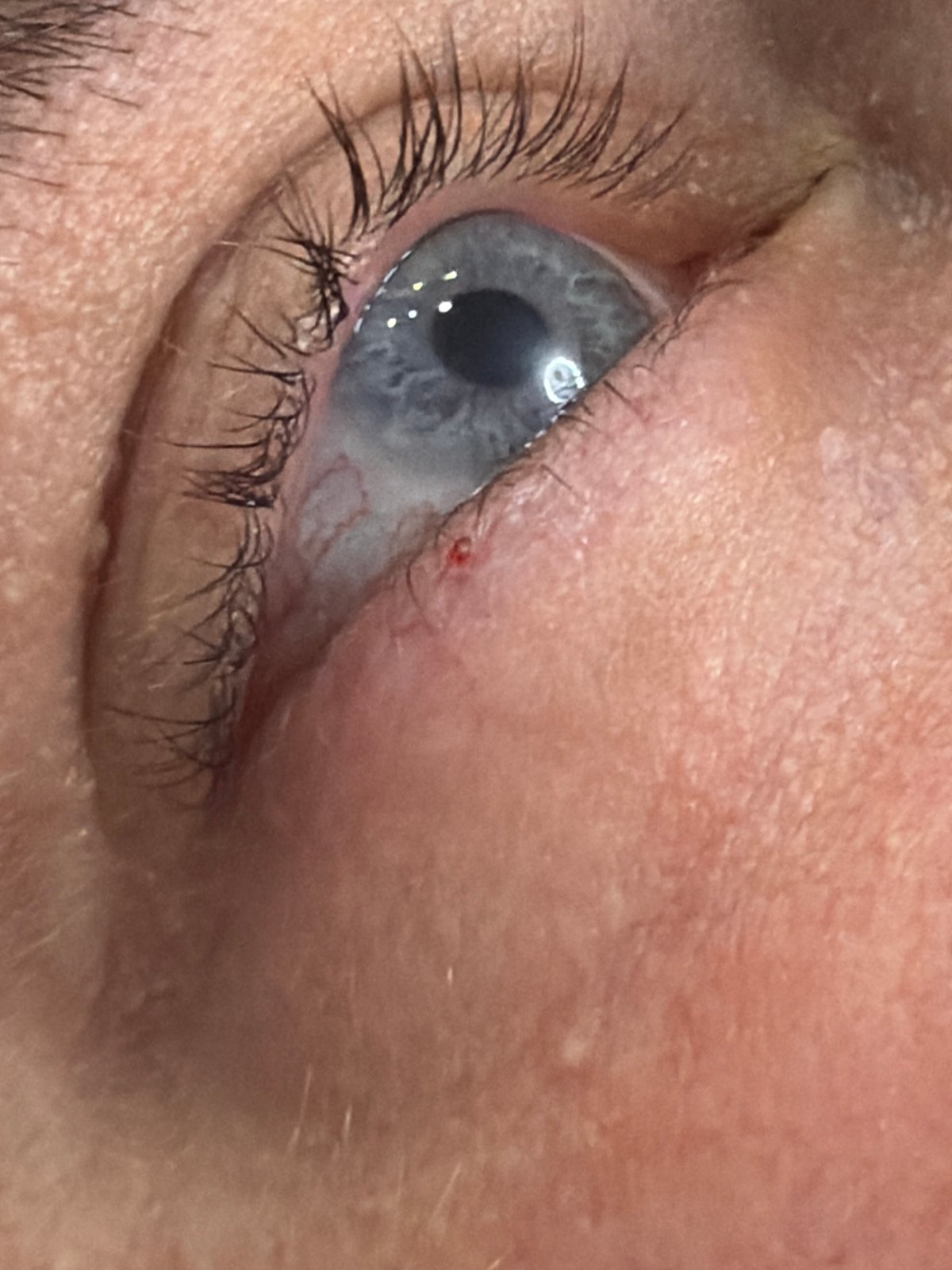 Macro eye portraits shot in close succession, Узюково