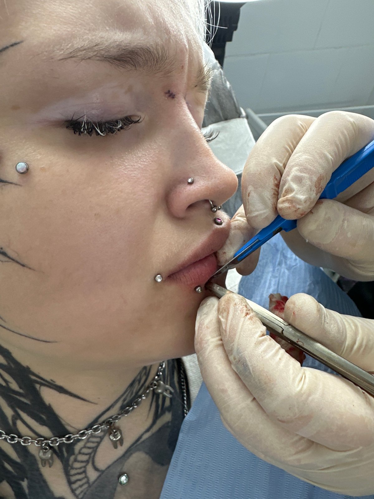 Tattooed individual receives body modification work in Saratov studio
