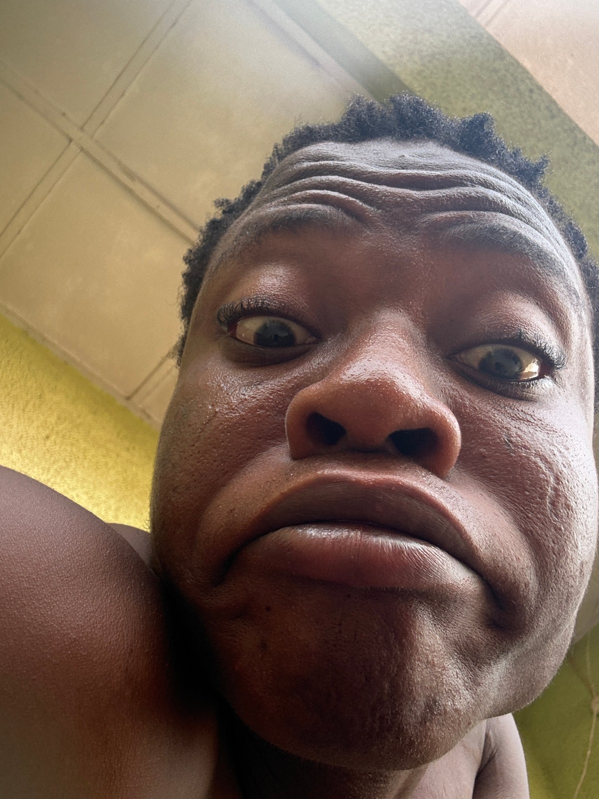Individual observed with tilted head, contorted expression