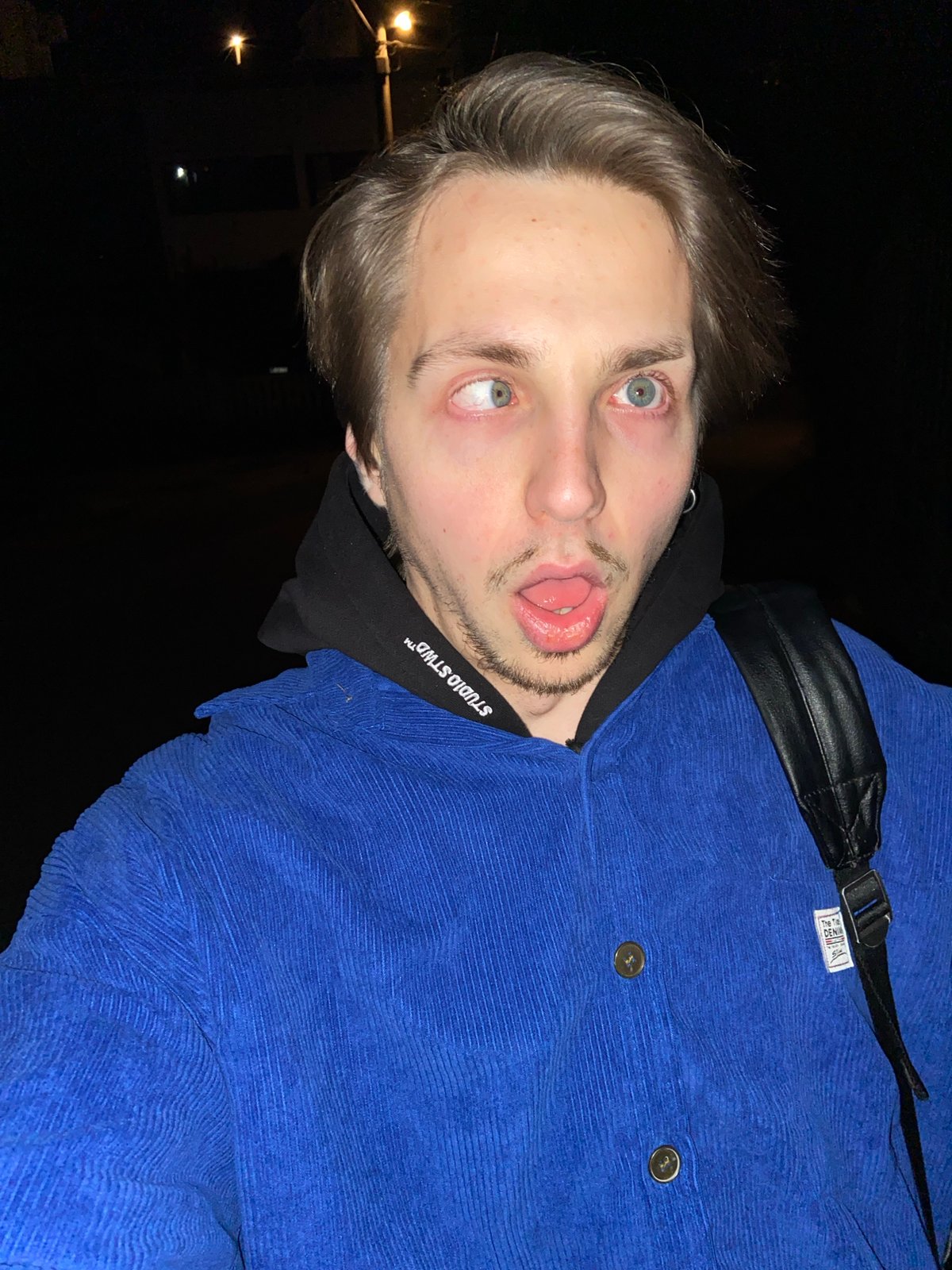 Disoriented man observed in outdoor setting in Šušanj, Montenegro