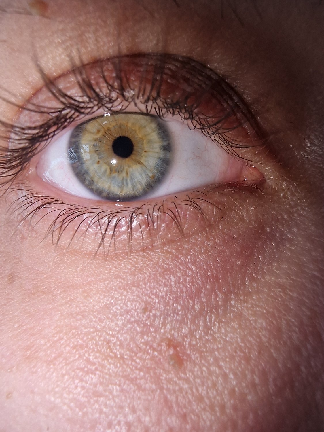 Close-up eye photographs captured from multiple angles within seconds