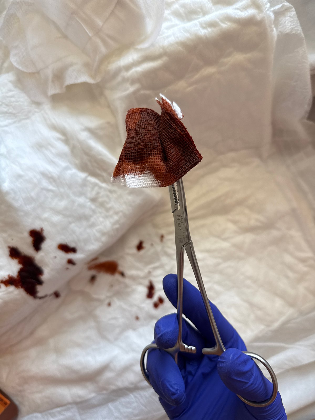 Medical procedure documented in Pleven, Bulgaria