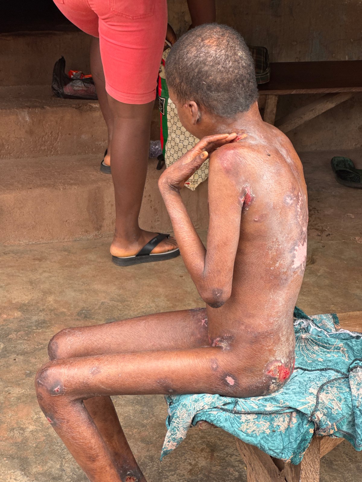 Everyday moments in Enugu, including injury and street-level life