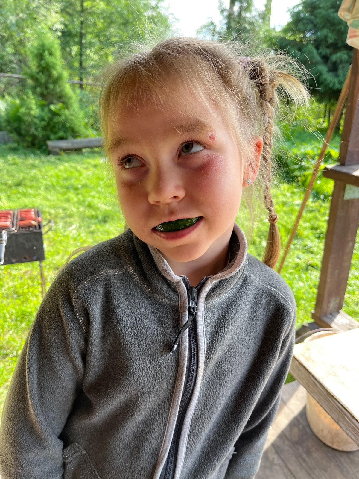 Child with minor injury observed in Chaikovsky, Russia