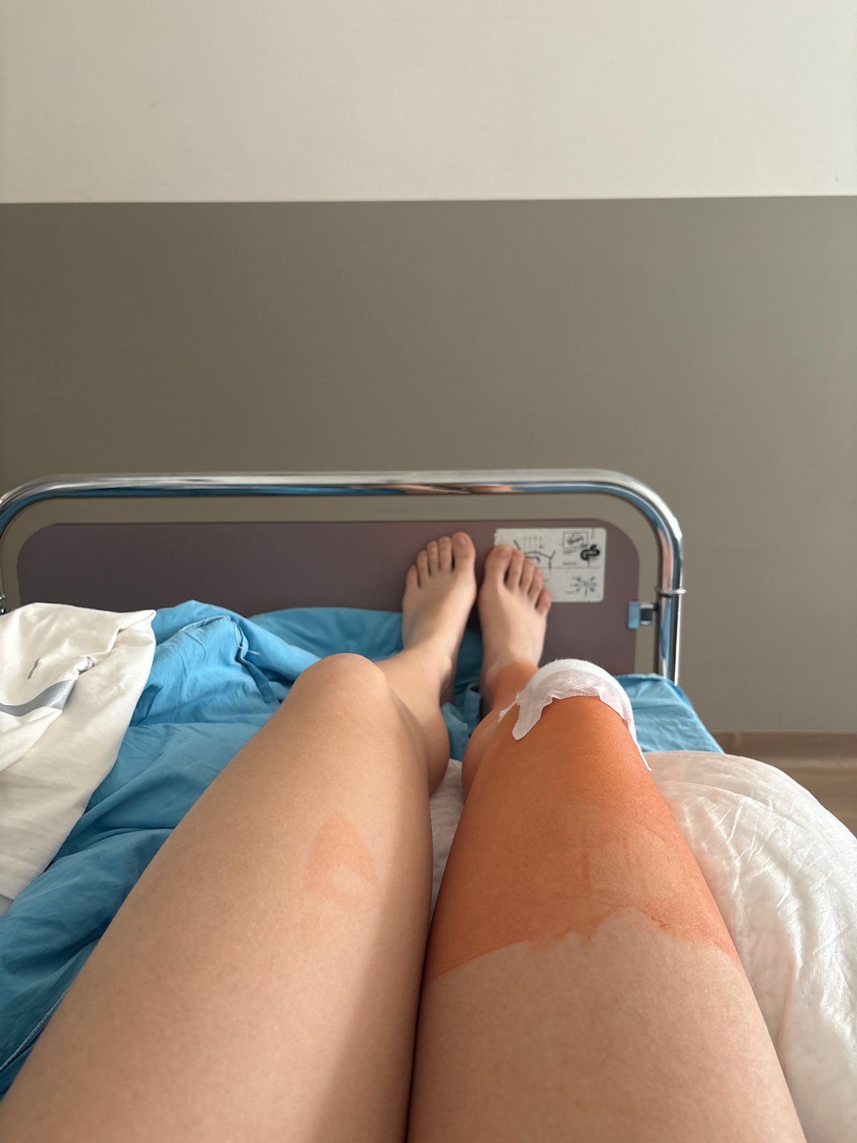Student recovers from leg injury in Sofia hospital bed