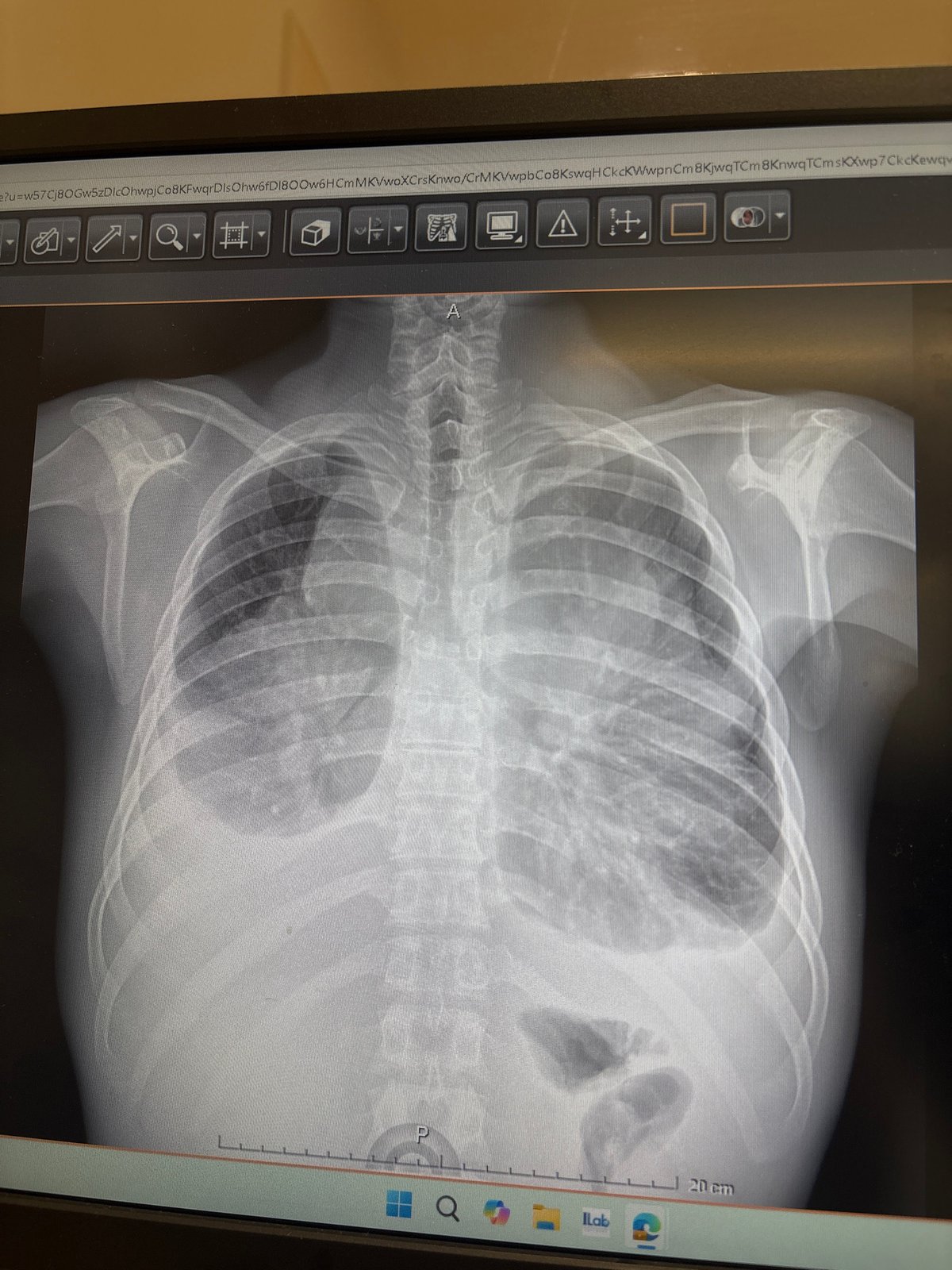 Medical CT scanner documented at Puebla healthcare facility