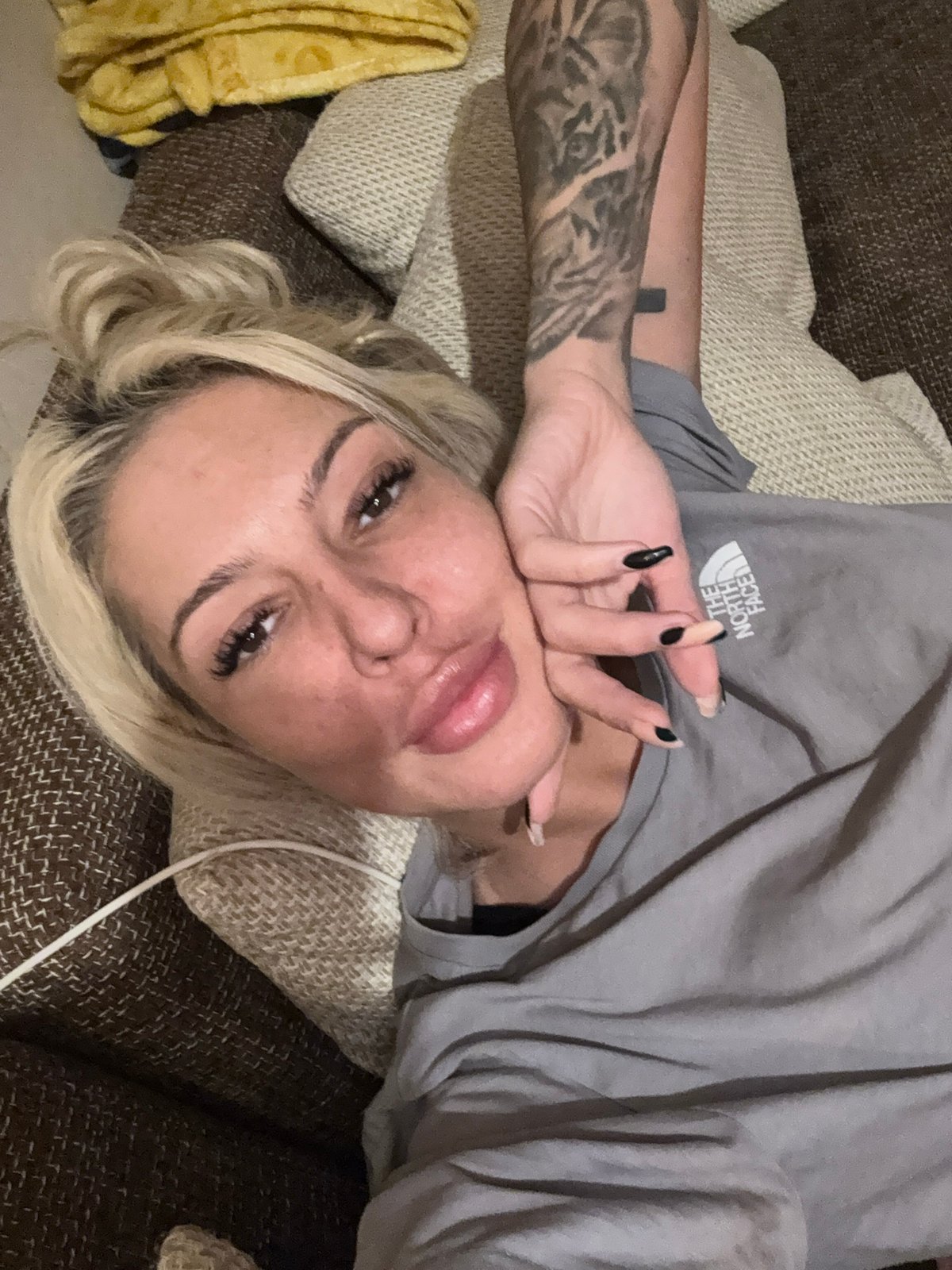 Woman with swollen lips photographed on couch in Plovdiv