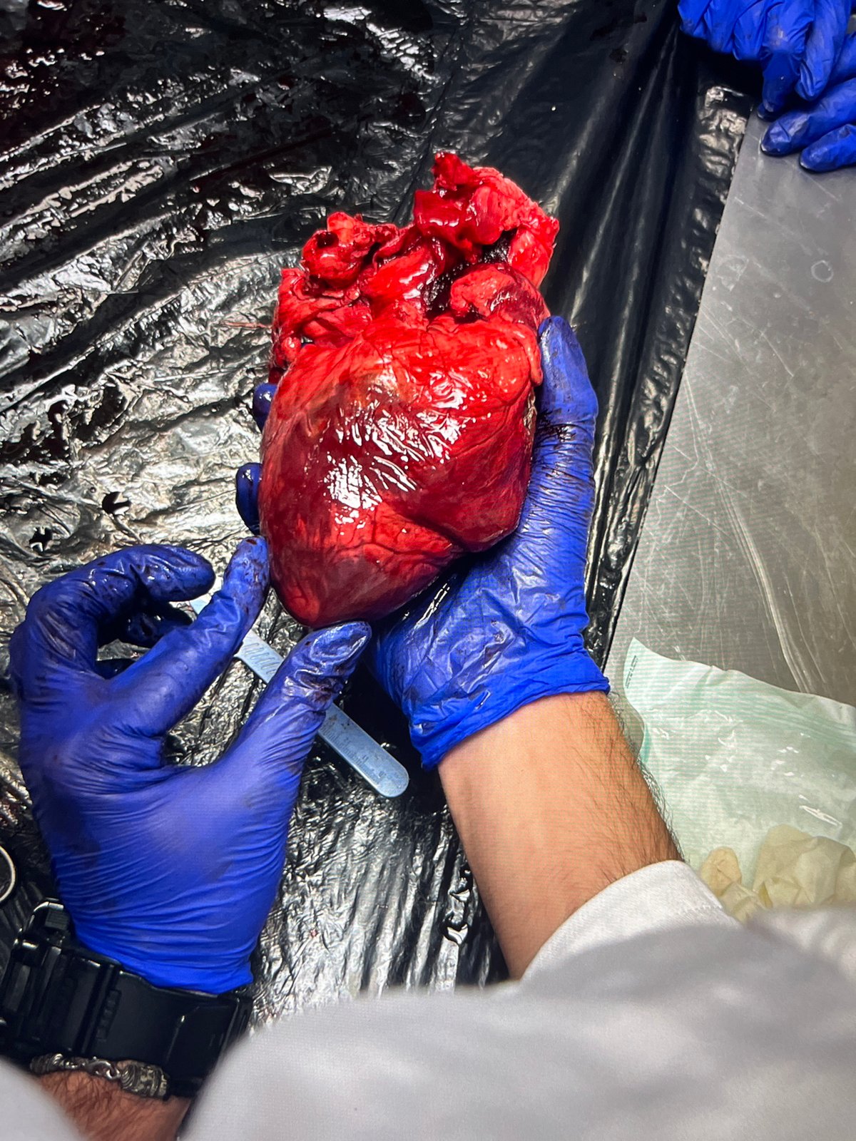 Medical examination involves human heart dissection, louse microscopy analysis