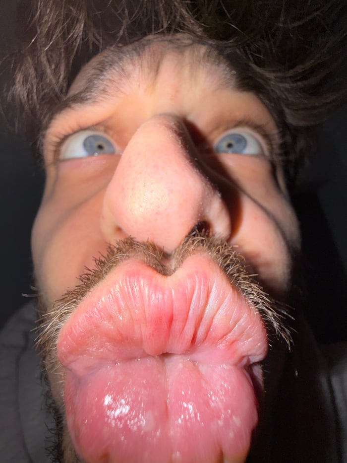 Extensive close-up documentation of individual captured in Strasbourg