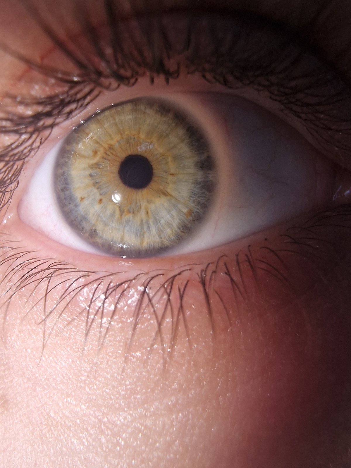 Close-up eye documentation recorded in early morning hours