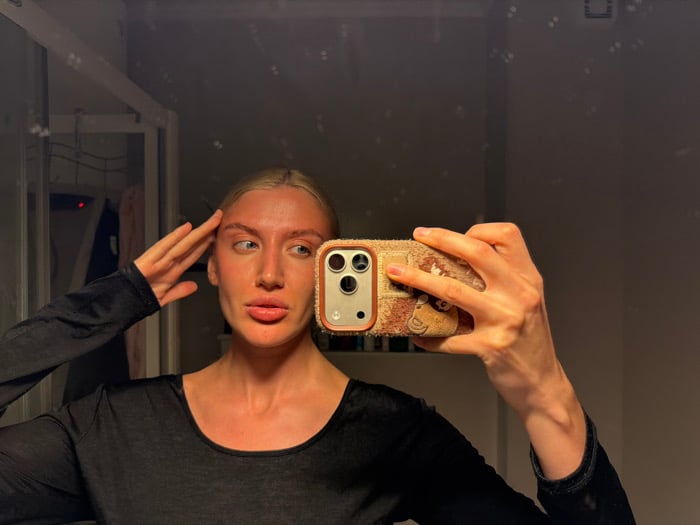 Woman documents sunburn in bathroom selfies in Budva Montenegro
