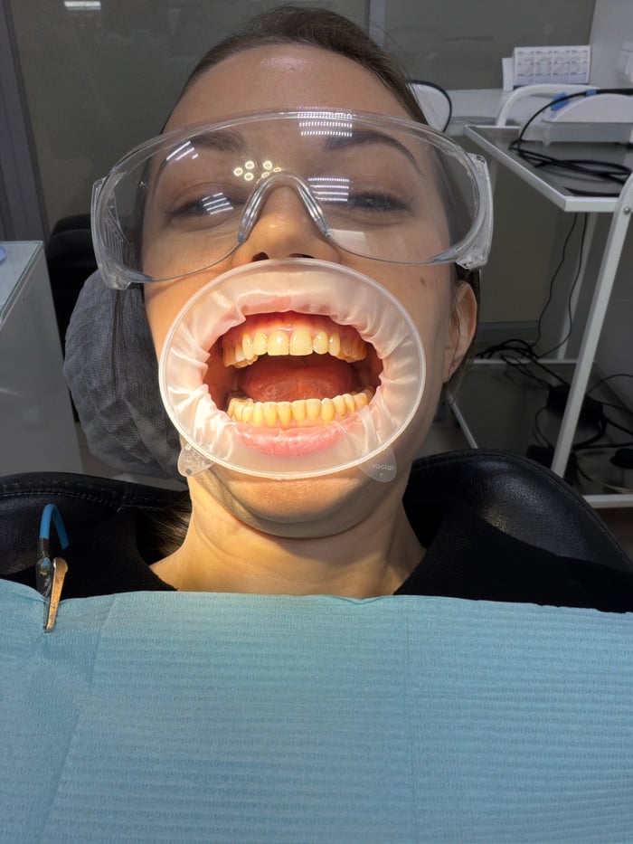 Woman undergoes dental procedure, documents experience through multiple perspectives