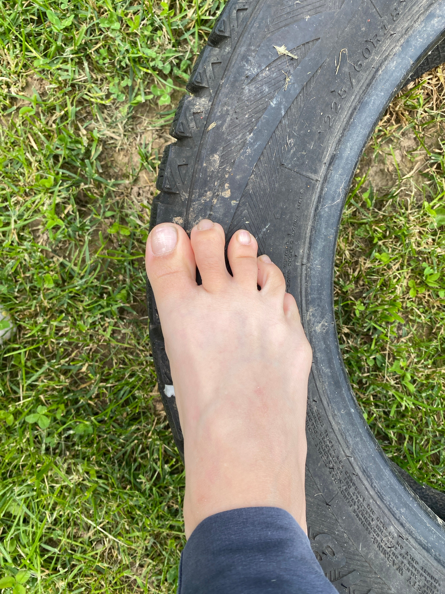 A bare human foot, displaying visible toenails and toes, is positioned on a patch of green grass. Partially visible on the right side of the image is a black tire, which appears to be a car tire with visible tread and text markings. The foot is facing upwards and slightly towards the left. The background consists of more grass and a dirt surface. No specific urban location is discernible.