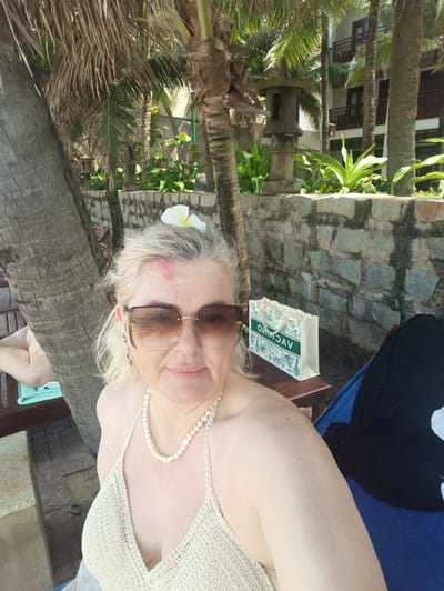 A woman with blonde hair and a red mark on her forehead is pictured at what appears to be a tropical resort in Phu Thuy Ward, Vietnam. She is wearing a beige crocheted bikini top and a pearl necklace. Large, brown-tinted sunglasses with gold frames are perched on her nose, and a white flower is tucked behind her ear. She is seated next to a wooden table with a shopping bag on it. The bag is cream-colored with a green floral pattern and text that appears to read "OVHAOV" or similar.

The background suggests a sunny day, with palm trees and a stone wall visible. A stone lantern stands near a building with multiple balconies, indicative of hotel accommodations. To the left of the woman, part of another person is visible, lying on a lounge chair with a light blue towel. The overall scene conveys a relaxed vacation atmosphere.