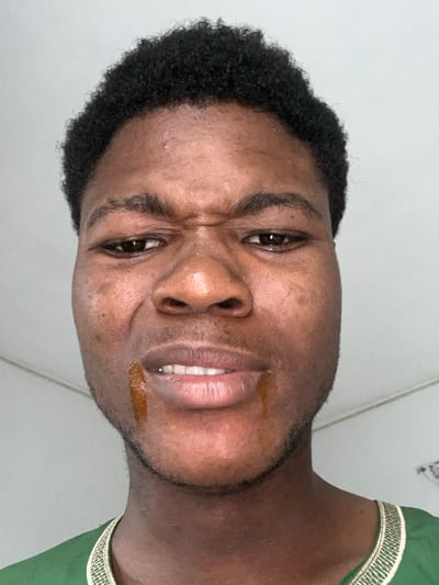 The image is a close-up, low-angle, headshot of a young Black male. He has short, dark, curly hair and is making a disgusted or displeased facial expression with furrowed brows and wrinkled nose. There is a streak of a dark, viscous substance running down the left side of his chin. He is wearing a green garment with a gold embroidered trim. The background appears to be a plain, light-colored wall and ceiling, suggesting an indoor setting. The image was taken in Ihiagwa, Nigeria.