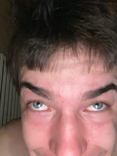 This is a close-up, head-and-shoulders selfie of a young person with brown hair, which is styled with bangs that fall across their forehead. The person has light-colored eyes, with the right eye appearing slightly more in focus than the left. Their skin is fair and shows some redness, particularly around the eyes and cheeks. The person's mouth is partially visible and appears to be smiling. The background consists of what looks like a radiator with vertical slats, suggesting an indoor environment. The image's composition is amateur, with the camera held close to the subject's face, creating a sense of intimacy. There is no visible indication of the city of Jihlava, Czechia.