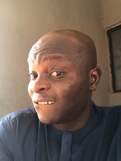 An indoor close-up portrait features an adult male of African descent, with a dark complexion and a closely shaved head. He is wearing a dark blue traditional garment with vertical stripes on the left shoulder and a textured, embroidered neckline. The man's face, illuminated from the left, displays prominent horizontal forehead wrinkles. His dark brown eyes are wide open, with a reddish tint visible in the sclera. His mouth is slightly open, revealing his upper teeth, including a noticeable gap (diastema) between the central incisors. Minor stubble and skin texture are visible on his cheeks and jawline. He is looking directly forward, towards the viewer. The background consists of a plain, light brown-grey wall, with a partial view of a dark-framed window or opening in the upper right quadrant. This scene is located within the city of Egboje, Nigeria.