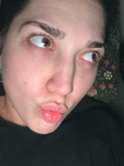 The image presents a close-up, angled view of a person's face, primarily from the nose upwards, with lips prominently featured to the right. The person has fair skin, dark brown eyes that are rolled upwards, and thick, dark eyebrows. Their lips are pursed and puckered, forming a "kissing" or "duck" face. A few small, reddish spots are visible on the cheek and around the nose.
Behind the person's head, a dark fabric with a floral pattern of white, pink, and red flowers and green leaves is visible, suggesting a pillow or a piece of bedding. To the right of the face, a plain, dark fabric, likely clothing or another part of the bedding, fills the background.
The subject appears to be lying down or reclining indoors. The upward gaze and puckered lips suggest a playful or expressive pose. There is no visible text in the image. The image was taken in Schiltigheim, France.