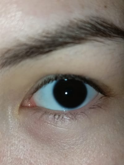 This is a close-up, slightly blurry photograph of a human eye. The iris is a dark color, likely brown or black, and the pupil is a deep black. The sclera, the white part of the eye, is visible and appears a pale blue due to lighting. The eyelashes are dark and short. Above the eye, a portion of an eyebrow with dark hairs is visible. The skin surrounding the eye is fair and appears to have a slightly textured surface with some small pores. There is a subtle sheen on the skin, suggesting it might be slightly moist or oily. The lighting in the image is somewhat harsh, causing a reflection on the surface of the eye. The overall impression is a snapshot of a single eye, with no specific activity or event clearly depicted. The context of Shymkent, Kazakhstan does not provide any visual cues within the image itself.