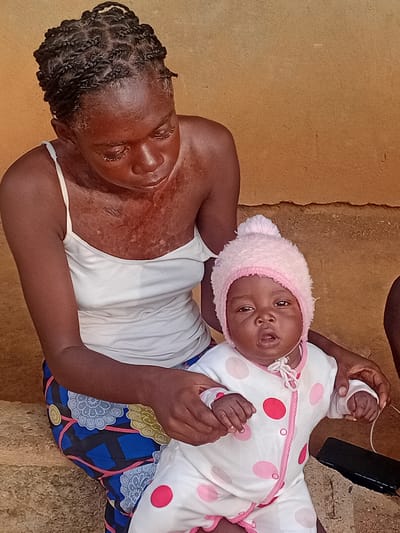 In Yelwa, Nigeria, a young Black woman with braided hair and visible skin irritation on her chest and arms sits with a baby. The woman wears a white tank top and a brightly patterned skirt. The baby, dressed in a pink and white polka-dotted onesie and a pink beanie, is held by the woman. The background consists of a textured, orange-brown wall. A black smartphone is visible on the ground to the right of the baby.