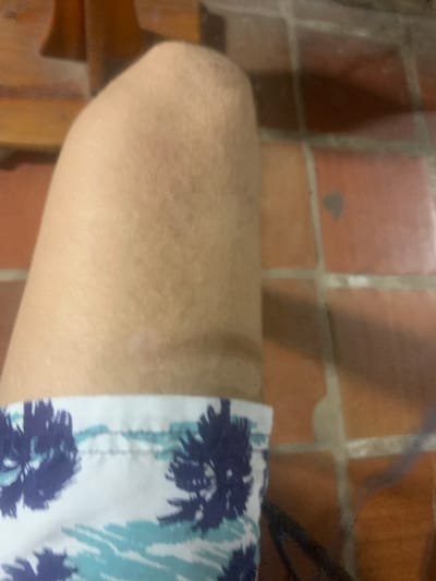 The image shows a close-up view of a person's thigh, wearing shorts with a blue and white tropical print. The background consists of terracotta-colored floor tiles with visible grout lines. A wooden surface is visible in the upper left corner. The lighting suggests an indoor or shaded outdoor setting. There is no discernible location in Pedro González, Venezuela.