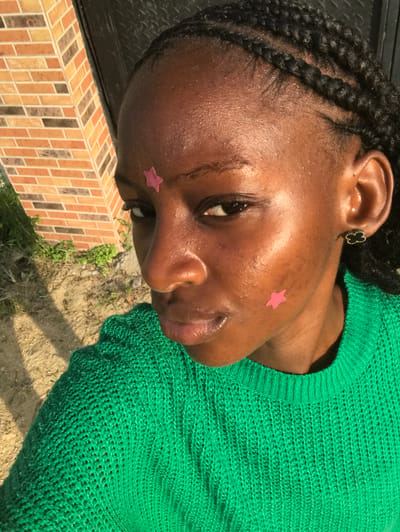 A woman with dark skin wears a green knit sweater and has braids. There's a small pink star sticker on her cheek near her nose. Her skin appears glossy. The image is angled, showing the side of her face and part of her upper body. A brick-tiled surface and some greenery are visible in the background, along with what appears to be dirt or sand. She has a gold clover-shaped earring.