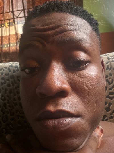 This image is a close-up selfie of a Black individual, seemingly taken indoors, as suggested by the presence of a leopard-print patterned cushion and a curtain with vertical stripes and horizontal yellow and brown bands in the background. The individual's face is the primary subject, with a focus on their features. Their skin appears moist, possibly due to sweat or tears, with prominent wrinkles on the forehead and a visible tear track on the cheekbone. The lighting highlights the texture of the skin and creates shadows that emphasize the contours of the face, including the nose and lips. The hair is short and dark, with a textured, curly appearance. The individual's eyes are partially closed, and their lips are slightly parted. The overall mood of the image could be interpreted as somber or introspective due to the facial expression and the glistening skin. The specific location within Ikorodu, Nigeria, cannot be determined from the visual information provided in the image itself.