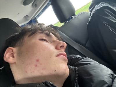 The scene depicts the interior of a vehicle in Dettwiller, France, during daytime. A young male subject, appearing to be a teenager, is positioned in a passenger seat, his head tilted back with eyes partially closed, gazing upwards and to his right. He possesses short, dark, curly hair and exhibits multiple erythematous papules on his right cheek and jawline. The subject is dressed in a dark, possibly black, puffer-style jacket, with a seatbelt visible across his chest. To his right, in an adjacent seat, a second individual is partially visible, wearing a dark hooded garment. The external environment, viewed through the vehicle window, consists of a green, grassy landscape under an overcast sky.